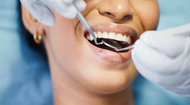 Best Emergency Dental Care for Abscessed Tooth in Rodney Village, DE